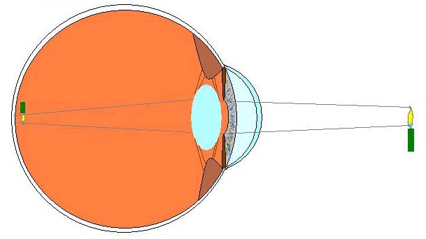 optisch normaal oog accommoderend